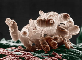 Water Testing CT Ecoli coliform Bacteria